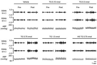 High Salt Intake Augments Excitability of PVN Neurons in Rats: Role of the Endoplasmic Reticulum Ca2+ Store